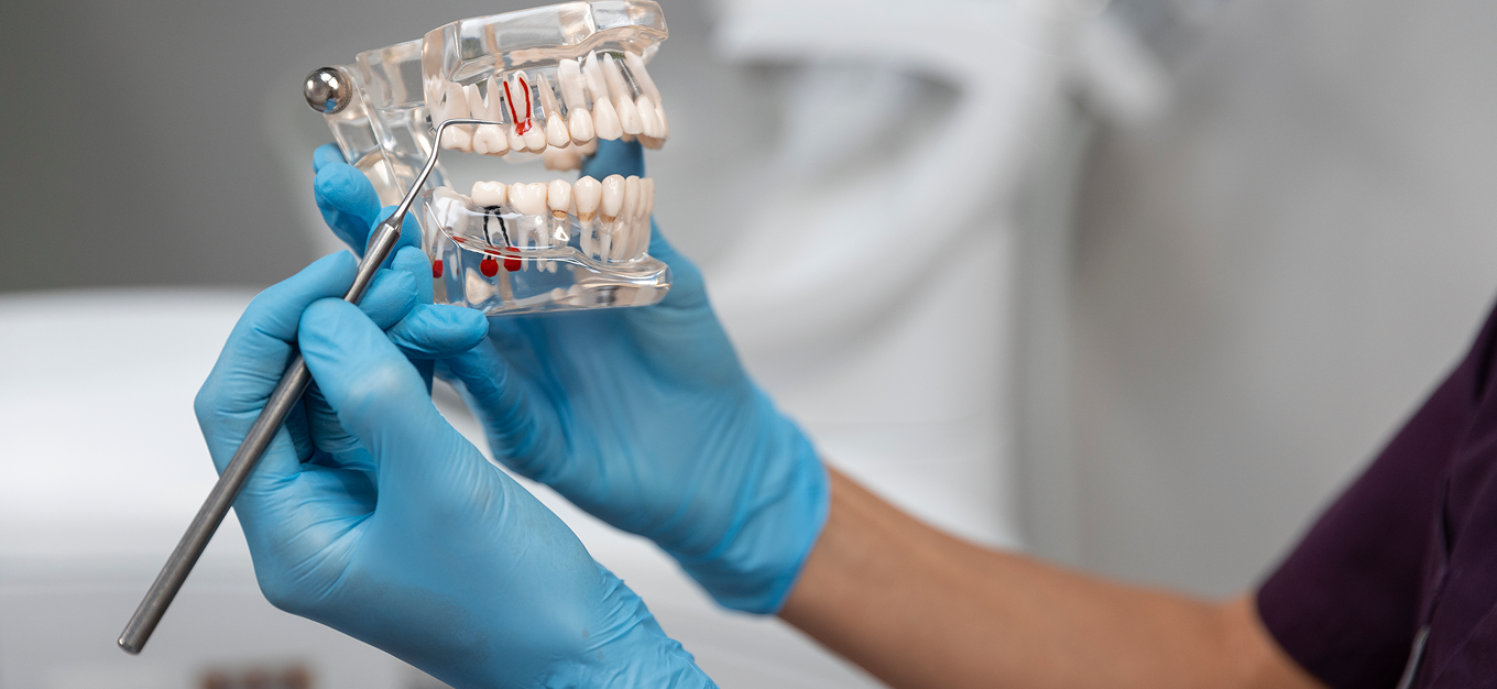 Grado Superior en Prótesis Dental